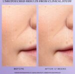 ⁦Lancôme RÉNERGIE H.C.F. Triple Serum – Plumping & Dark-Spot Reducing 50 ML⁩ - الصورة ⁦3⁩