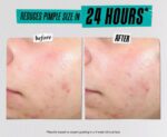 ⁦Kiehl’s Since 1851 Ditch The Zituation Gift Set for Acne-Prone Skin⁩ - الصورة ⁦3⁩
