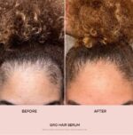 ⁦Vegamour GRO Hair Serum for Thinning Hair 30ml⁩ - الصورة ⁦5⁩