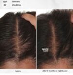 ⁦K18 FutureIQ™ Hair Longevity Serum for Graying, Thinning & Scalp Aging 90ml⁩ - الصورة ⁦5⁩