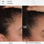 ⁦K18 FutureIQ™ Hair Longevity Serum for Graying, Thinning & Scalp Aging 90ml⁩ - الصورة ⁦6⁩