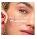 ⁦Acne Clearing Pads – 2% Salicylic Acid Acne Treatment⁩ - الصورة ⁦2⁩