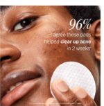 ⁦Acne Clearing Pads – 2% Salicylic Acid Acne Treatment⁩ - الصورة ⁦7⁩